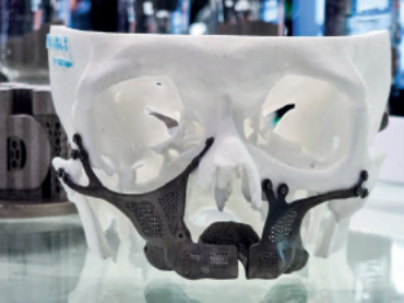 3D tisk: slitiny tantalu a niobu</br>pro biokompatibilní implantáty